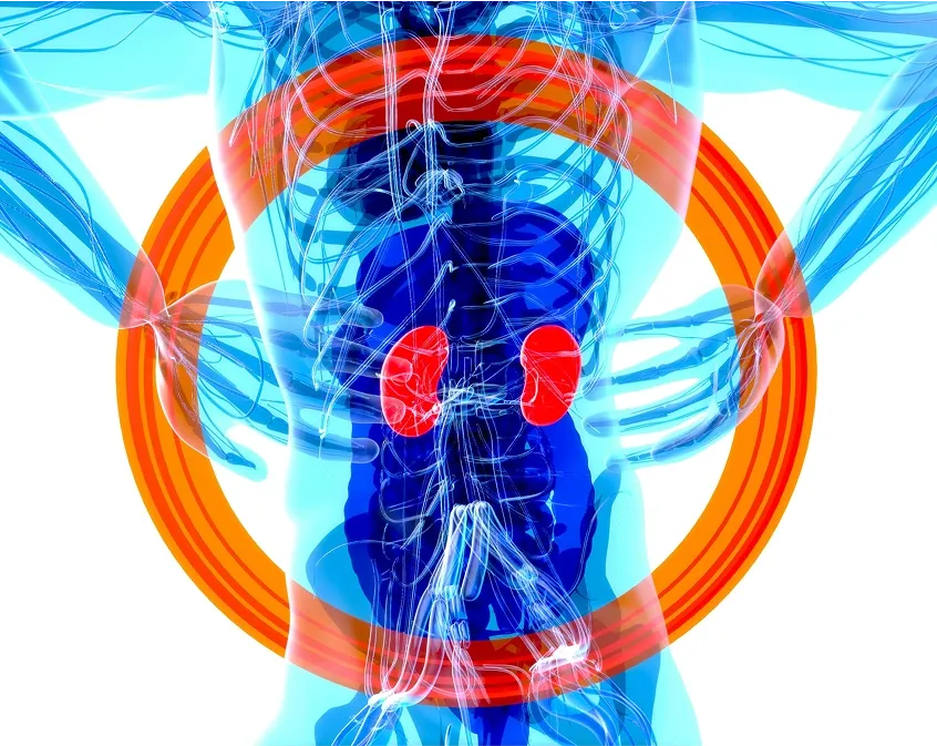 How to Prevent Kidney Disease